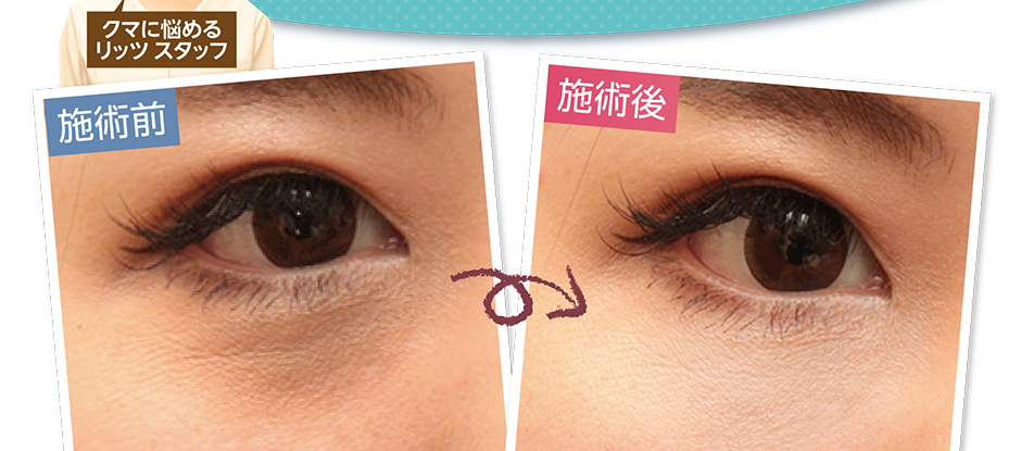 クマに悩めるスタッフ