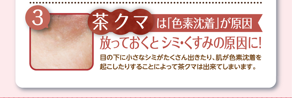 茶クマはは「色素沈着」が原因放っておくとシミ・くすみの原因に！