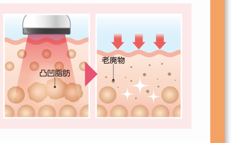 凸凹脂肪撃退マシン