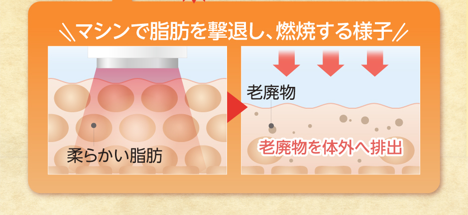 マシン2　痩せやすい体質に変える！　イーエムエスEMS　痩せたい部分の筋肉を集中して鍛え、代謝を高めます。運動では鍛えにくい、内臓や骨盤を支えるコアマッスルにアプローチし、痩せやすい体質に変えていきます。