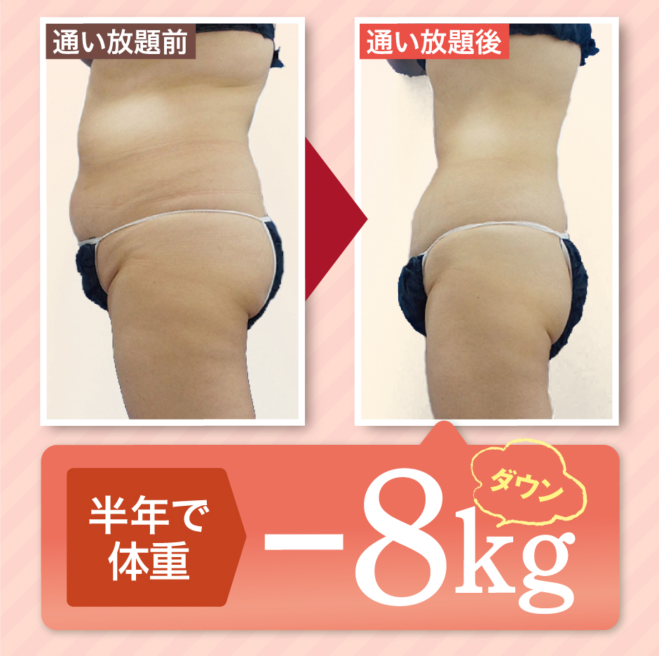 ふくらはぎ太もも お尻 お腹 腰肉 二の腕　二の腕から太ももまでできます！