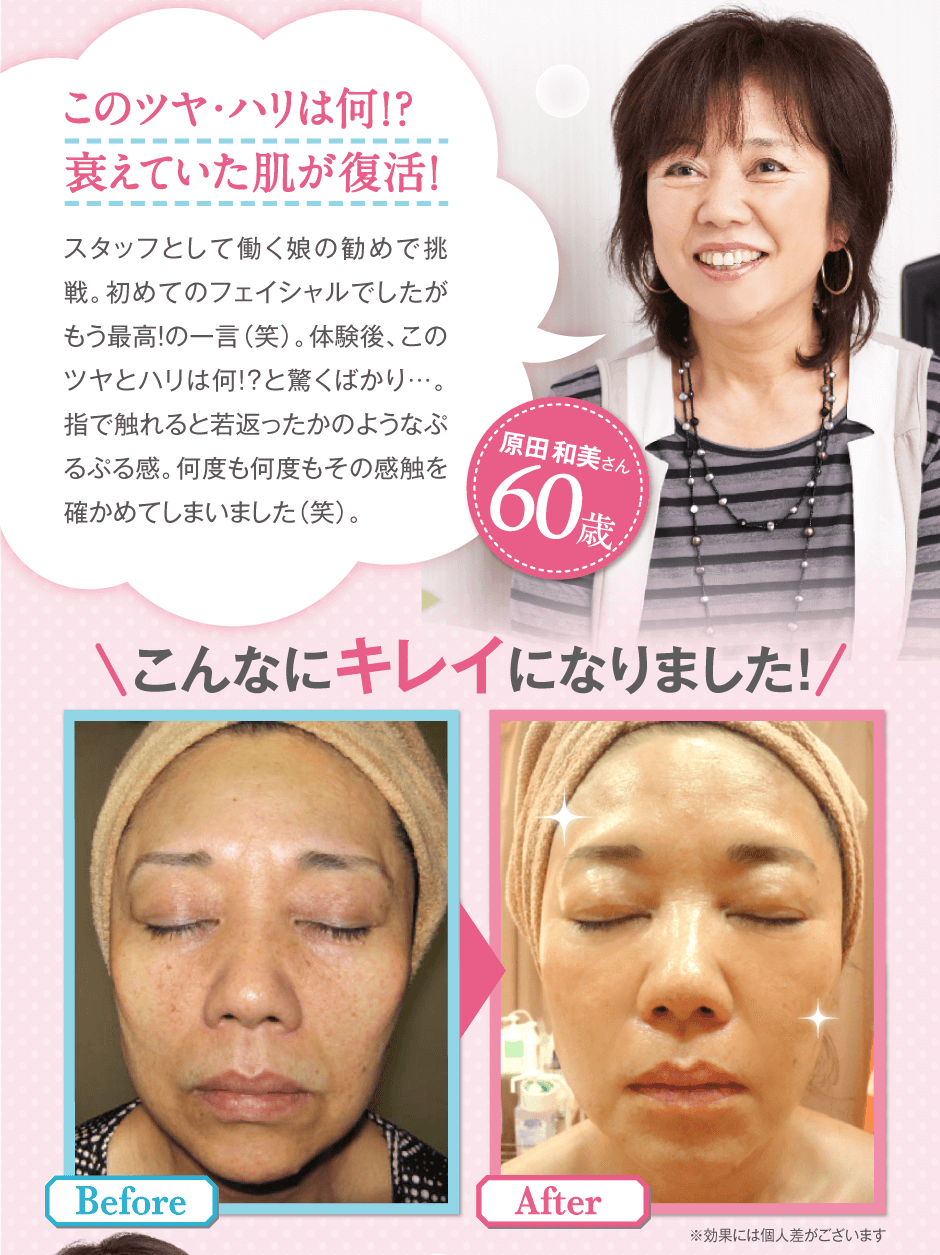 このツヤ・ハリは何！？衰えていた肌が復活！スタッフとして働く娘の勧めで挑戦。初めてのフェイシャルでしたがもう最高！の一言（笑）。体験後、このツヤとハリは何!?と驚くばかり…。指で触れると若返ったかのようなぷるぷる感。何度も何度もその感触を確かめてしまいました（笑）。