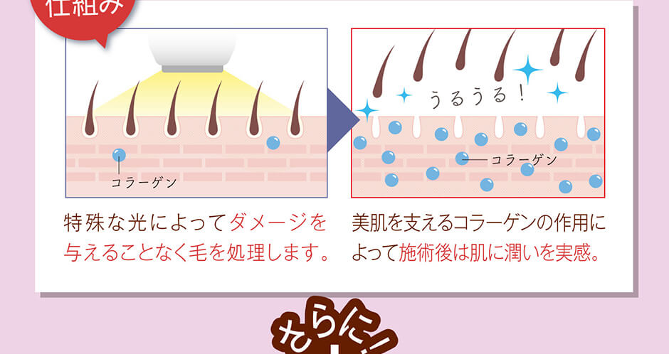 美肌顔脱毛16回コース