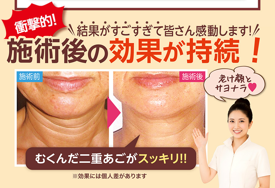 施術後の効果が持続！結果がすごすぎて皆さん感動します！