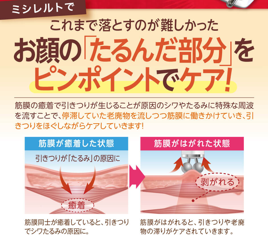 これまで落とすのが難しかったお顔のたるんだ部分をピンポイントでケア！温熱作用により、体内温度が上昇するので、血流やリンパの流れが促進。その場で脂肪の排泄を促す、リバウンドしずらい画期的なマシンです。